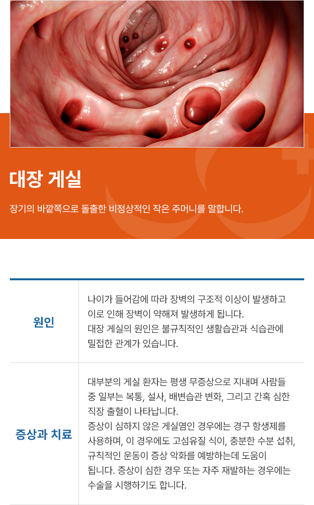 ���� �Խ�